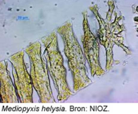 Mediopyxis helysia. Bron: NIOZ.