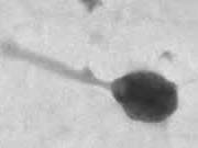 Afb 1. Een virus uit zee. Electronenmicroscopische foto (Bron: Wilthsire et. al. 2010)