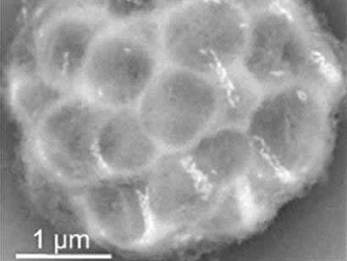 Afbeelding 1. Een MMP uit de Wadden. µm=micrometer. Bron: Wenter et al., 2009.